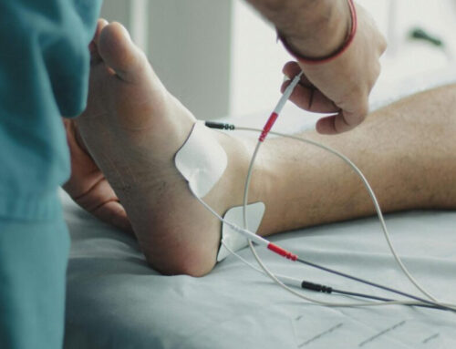 疼痛管理的長青樹：TENS